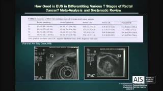 The Role of Endoscopic Ultrasound in the Evaluation of Rectal Cancer [upl. by Rez]