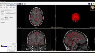 Analyze 150  Segment Region Grow 2D [upl. by Landy5]