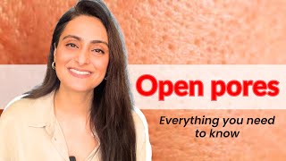 Open pores How to treat  Creams to use  Lasers  Dermatologist Dr Aanchal [upl. by Ayiak913]