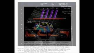 Ecografía Doppler Obstetrico Libro [upl. by Daffie]