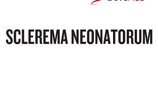 Sclerema Neonatorum [upl. by Oag]