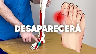 Automasaje para aliviar el hallux valgus o “juanetequot [upl. by Salkcin292]