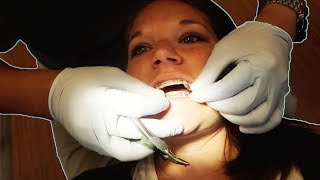 PAINFUL ORTHODONTIST VISIT ADULT BRACES UPDATE [upl. by Leaper]