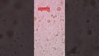 Entamoeba under the microscope laboratory microscope mls cls stoolanalysis fecalysis medtech [upl. by Aiuqal254]