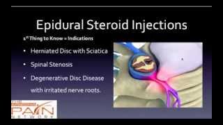 5 Things to Know About Epidural Steroid Injections 602 5076550 [upl. by Hoagland]