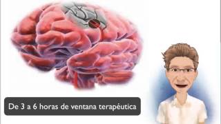 FISIOPATOLOGIA ICTUS ISQUÉMICO [upl. by Casaleggio]