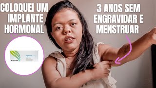 COLOQUEI UM IMPLANTE HORMONAL E QUASE DEU ERRADOMÃE COM NANISMO [upl. by Ahsikam]