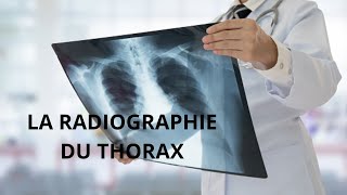 Critères dinterprétation dune radiographie thoracique radiologie [upl. by Arykat545]