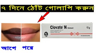 Clovate N Ointment Review Bangla । Benefits Uses Price Side Effects  ToTo Company BD [upl. by Yraek]