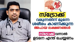 സ്ട്രോക്ക് എങ്ങനെ നേരത്തെ തിരിച്ചറിയാം  Stroke Malayalam  Arogyam [upl. by Aihsas]