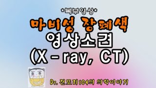 마비성 장폐색증paralyticadynamic ileus 영상소견abdominal Xray CT [upl. by Ginnifer787]