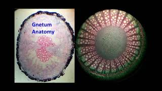 Gnetum Anatomy [upl. by Ajnek62]