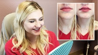 1 Syringe of Juvederm Lip Injections from Doctor Cynthia Cote [upl. by Alyakim]