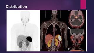 Neuroendocrine Tumors imaging with Ga 68 Somatostatin analogs MCQ nuclearmedicineMCQ [upl. by Ahsenad]