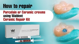 How to repair Porcelain or Ceramic crowns using Waldent Ceramic Repair Kit [upl. by Rohpotsirhc]