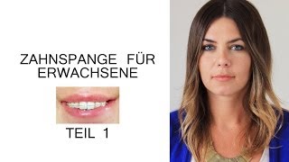 Zahnspange für Erwachsene  Der erste Schritt [upl. by Ahseikal590]