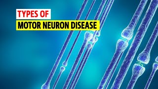 Types of Motor neuron disease [upl. by Braynard636]