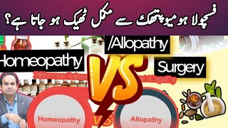 Homeopathy or SurgeryAllopathy  Anal Fistula best treatment [upl. by Beitnes]