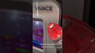 Vivace radiofrequency microneedling [upl. by Pamelina]