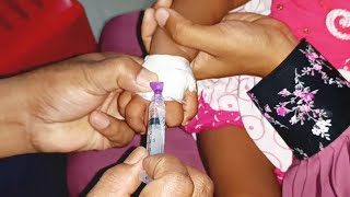 Meropenem injection Cannula  Child  তে Push 24 Ep 39 By Injection Tv [upl. by Jeb]