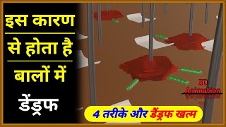 Blood infection in hindi [upl. by Honeyman]