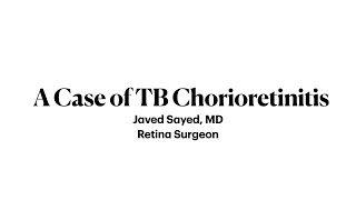 TB Chorioretinitis [upl. by Elbertina]