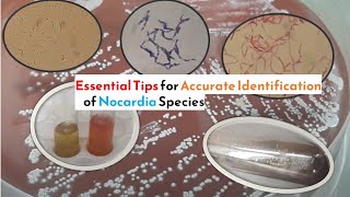 Essential Tips for Accurate Identification of Nocardia Species [upl. by Kho931]