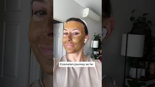 Cosmelan Depigmentation Peel  day 4 shorts cosmelan mesoestetic skincare pigmentation [upl. by Kilan]