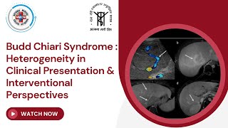 Budd Chiari Syndrome  Heterogeneity in Clinical Presentation amp Interventional Perspectives  Cases [upl. by Lokkin]