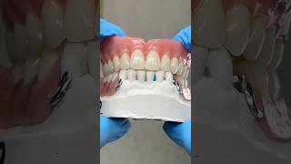 Upper Denture and Lower Partial lsk121shorts dentistteeth dentistry [upl. by Ariek]