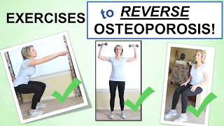 Reversing Osteoporosis Naturally Through Exercise – Best Exercises to Build Bone [upl. by Velasco]