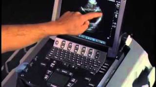 How to Echocardiography  Subcostal View [upl. by Adekram789]