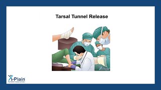 Tarsal Tunnel Release [upl. by Nitnilc61]