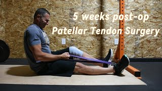 Update  5 weeks postop after ruptured Patellar tendon repair [upl. by Torrance]