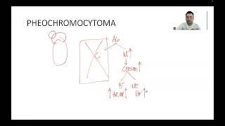 ENDOCRINE PHEOCHROMOCYTOMA [upl. by Einehpets]