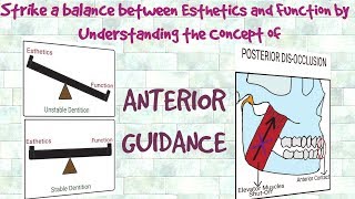 Anterior Guidance  Understanding the Concept [upl. by Steady]