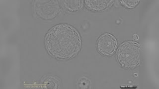 Growth of Liver Organoids in HepatiCult™ Culture Medium Under a Microscope [upl. by Barrett]