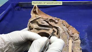 Pharynx I  Internal features [upl. by Kamal]