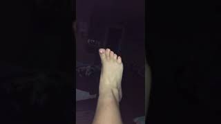 Cracking Sprained Ankle [upl. by Thistle]