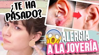 TIPS para la ALERGIA A LA JOYERÍA  ALERGIA AL NÍQUEL  MI HISTORIA [upl. by Schear]