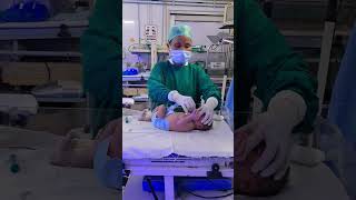 feeding tube clean process short video viral [upl. by Aikyn376]