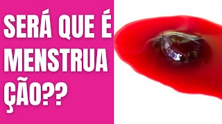 SERÁ que é MENSTRUAÇÃO ⚠️CUIDADO Nem todo SANGRAMENTO VAGINAL é MENSTRUAÇÃO  Dra Neide Pires [upl. by Averell]