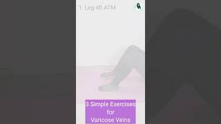 Varicose veins exercises varicoseveintreatment [upl. by Divd]