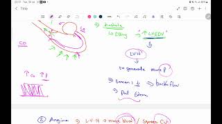 Valvular heart disease Aortic valvepart 2 [upl. by Annayr240]