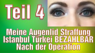 Schlupflider Operation Vorher Nachher Augenlidstraffung Erfahrung Türkei Oberlidstraffung [upl. by Brenza]