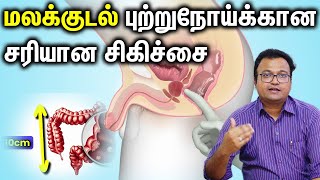 Rectal Cancer மலக்குடல் புற்றுநோய்க்கான சரியான சிகிச்சை Dr Dayananda Srinivasan [upl. by Kwapong]