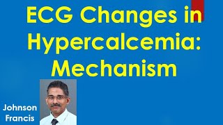 ECG Changes in Hypercalcemia Mechanism [upl. by Erine]