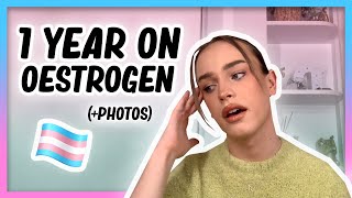 1 YEAR ON OESTROGEN Transition update with photos  Hormone Diaries [upl. by Atekan154]