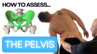 How to assess the pelvis [upl. by Schriever]