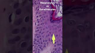 Melanocytes vs Keratinocytes From my normal skin histology 101 video pathology dermpath usmle [upl. by Brandie785]